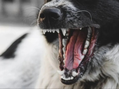 Pies pogryzł 11-latkę. Jest akt oskarżenia