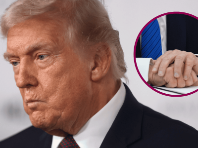 Plotkowano o poważnej chorobie Trumpa. Świat znów patrzy na jego dłonie