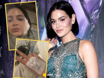 Honorata Skarbek trafiła do szpitala. 