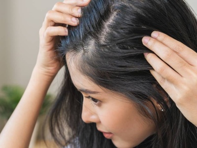 Kultowa ziołowa i rozgrzewająca wcierka teraz przeceniona! Wysyp baby hair już w 6 tygodni