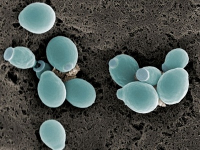 C. albicans powoduje, że czerniak jest bardziej złośliwy. Opisano mechanizm jego działania