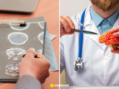 Przełom w walce z glejakiem. Naukowcy tworzą obiecującą terapię