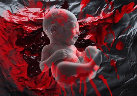 Australia: w wyniku nieudanej aborcji dziecko urodziło się żywe. Pozostawiono je na śmierć