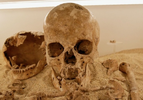 Choroba z paleolitu. Udało się zdiagnozować najstarszy przypadek choroby genetycznej