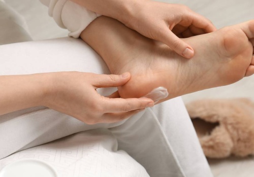 Ten krem za 4zł nawilża i regeneruje suche stopy i pięty! Zrogowacenia znikają w trymiga!