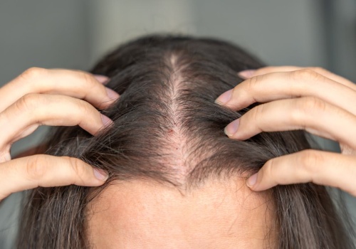 Cienkie i suche włosy? W tym wieku pasma już przestają się regenerować