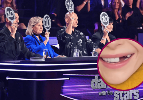 Znana gwiazda wybiła zęby! Miała wziąć udział w 