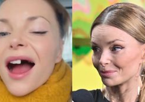 Dumna Izabella Miko prezentuje BRAKI W UZĘBIENIU: 