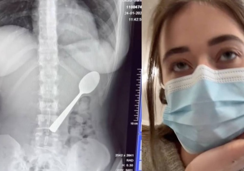 Niewiarygodne, co połknęła, gdy jadła jogurt. 