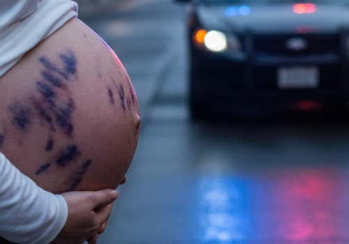 ATAK NA CIĘŻARNĄ PARTNERKĘ!