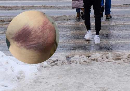 Recydywa na lodzie. Trzeci upadek mieszkańca Rzeszowa i “festiwal znieczulicy” w sieci