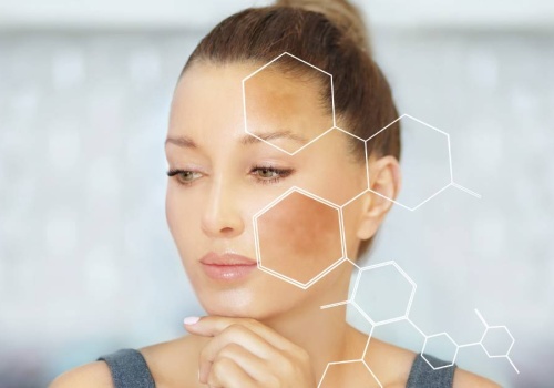 Ten krem usuwa z twarzy niedoskonałości jak gumka! Znikają przebarwienia i plamki starcze