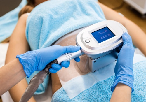 Kriolipoliza w Krakowie – jak wybrać profesjonalny gabinet i uniknąć rozczarowań?