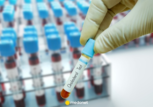 Nowe wytyczne dotyczące cholesterolu już w marcu. Znamy szczegóły