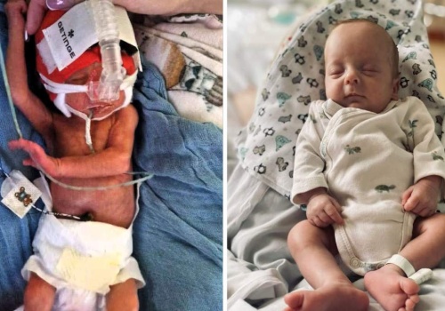 Antoś ważył 620 gramów. Medycy walczyli o niego przez dwa miesiące