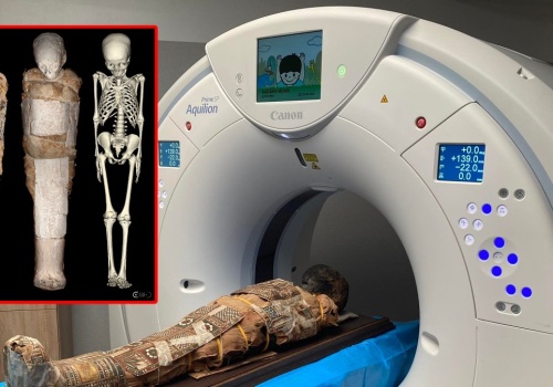 Zagadka tajemniczej mumii z Wrocławia rozwiązana. To ośmioletni chłopiec