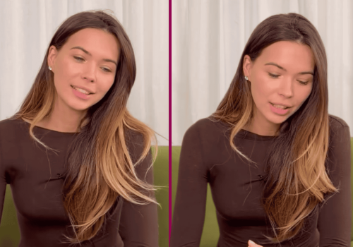 Sandra Kubicka naprawdę się na to zdecydowała. Pokazano zmiany twarzy