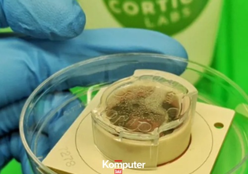 Wyhodowali ludzki mini-mózg. Poradził sobie z zadaniem lepiej od AI