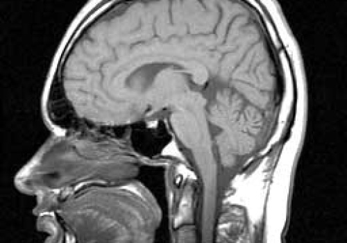Depresja kosztuje światową gospodarkę bilion dolarów rocznie