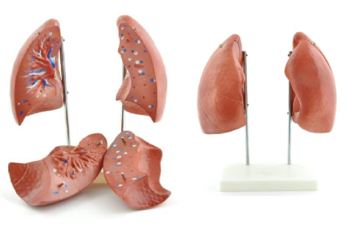 Koklusz – groźna choroba zakaźna układu oddechowego