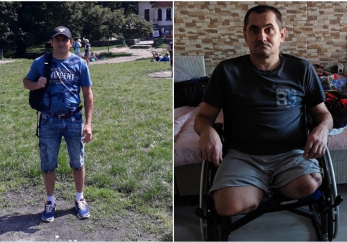 Stracił obie nogi w wypadku podczas pracy. Wsparcie można przekazać rozliczając się z fiskusem