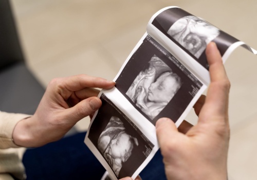 Aborcja to nie „opieka zdrowotna” – przed decyzją KE w sprawie inicjatywy „Mój głos, mój wybór!R …