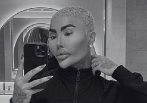 34-letni gwiazdor reality show nie żyje. Tuż przed śmiercią miał poddać się kolejnemu liftingowi pośladków