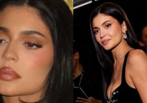 Kylie Jenner rozpuściła usta? 