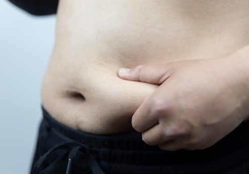 Lekarz będzie chętniej kwalifikował pacjenta do farmakologicznego leczenia otyłości