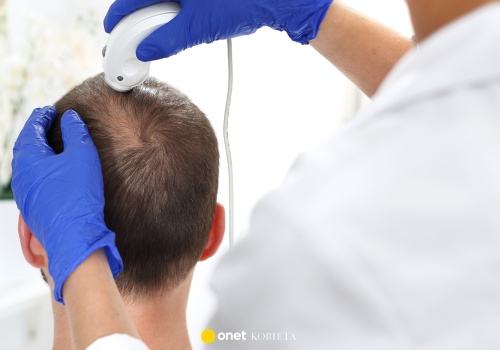 Przełom w wykrywaniu choroby Parkinsona. Naukowcy skupili się na włosach