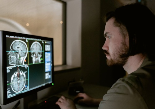 Przełom w leczeniu glejaka? Laser i immunoterapia wydłużają życie nawet do 3 lat