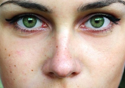 Masz pieprzyk w tym miejscu? To znak, że jesteś wybrańcem losu