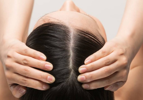 Ta wcierka zakotwicza wypadające włosy. Ekspresowo pojawią się baby hair przy linii czoła