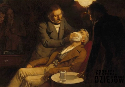 Operacje bez narkozy. To, co przeżywali pacjenci, mrozi krew