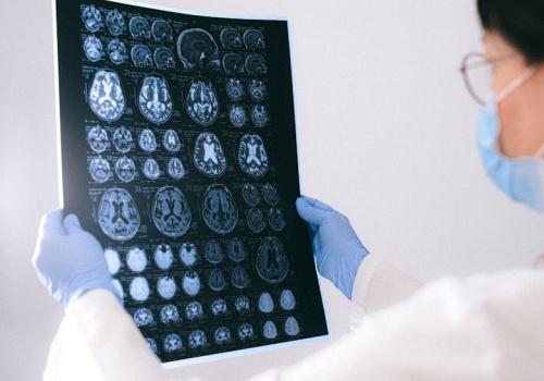 Terapia manualna a mózg: co wynika z analizy 47 badań neuroobrazowych?