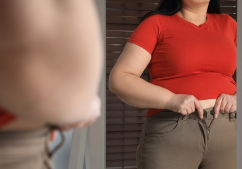 Jeszcze 30 lat temu to był margines. Dziś otyłość to w Polsce norma