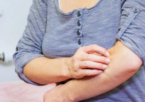 Jedz, a złagodzisz świąd i łuszczenie. Produkty zalecane są w chorobach skóry