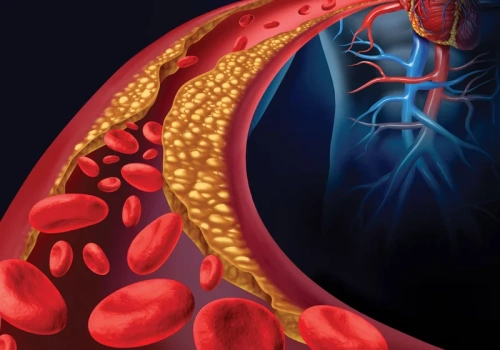 Cholesterol, czyli cichy zabójca. Eksperci obalają najgroźniejsze mity