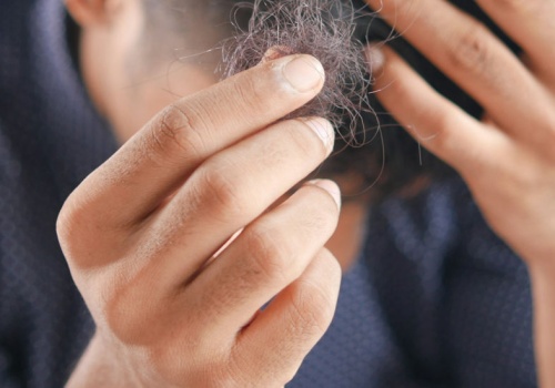 Koniec z łysieniem! Naukowcy ogłaszają przełom w walce z utratą włosów