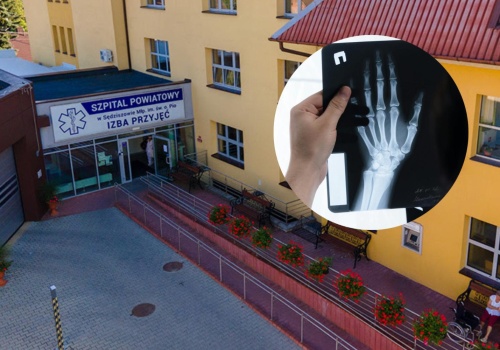 Zamieszanie ws. szpitala w Sędziszowie Małopolskim. Zwolnienia i pracownia RTG do likwidacji?