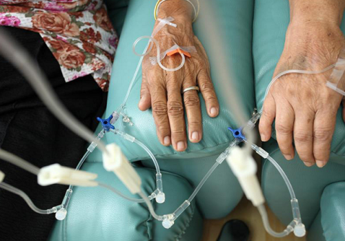 Odtajnione akta CIA ujawniają radzieckie badania z czasów zimnej wojny, łączące pasożyty z leczeniem nowotworów