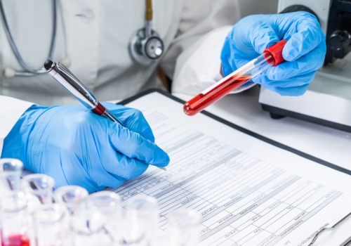 Nie ma bezpiecznego poziomu ołowiu. MZ przedstawia projekt nowych norm