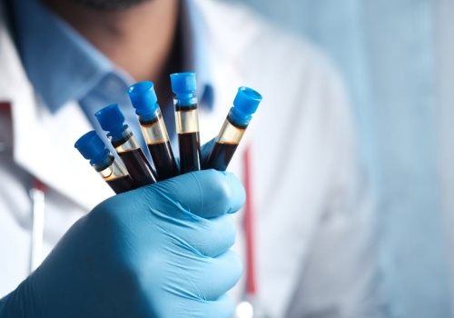 Koniec „bezpiecznego” poziomu ołowiu w pracy. MZ zaostrza normy i badania pracowników