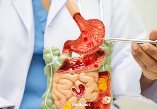 Bakterie jelitowe wpływają na serce. Odkrycie może zmienić leczenie choroby wieńcowej