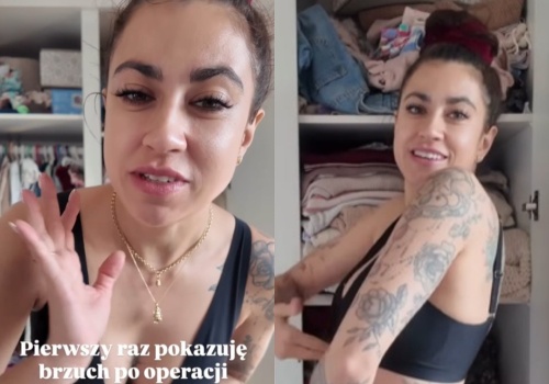 Maja Hyży odsłoniła brzuch miesiąc po operacji. 