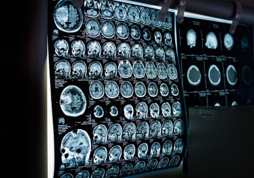 Zamrożone mózgi „ożyły”. Naukowcy z Niemiec dokonali przełomu