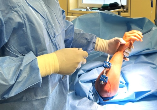 Nowoczesne zabiegi wydłużania kości u dzieci w Bielsku-Białej