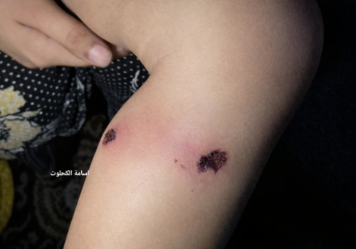 Izraelscy żołnierze torturowali rocznego chłopca, aby wymusić zeznania od ojca