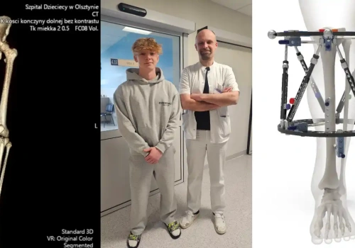 Ortopedzi ze Szpitala Dziecięcego w Olsztynie wykonają pierwszą na Warmii i Mazurach operację z zastosowaniem nowoczesnego zespolenia