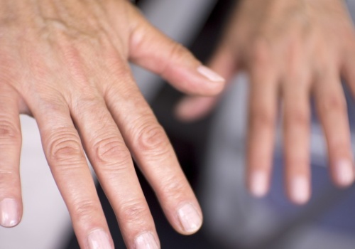 Ten objaw łatwo zlekceważyć. Drżenie rąk może mieć kilka ukrytych przyczyn